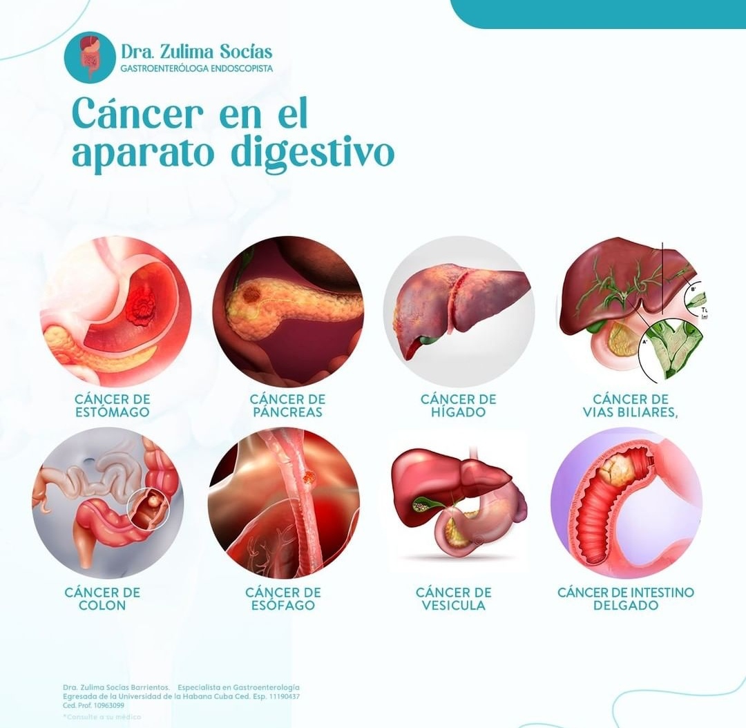 gastroenterologa-cancun-zulima-socias (7)
