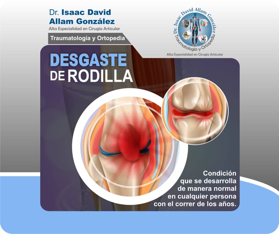 Dr-Isaac-Allam-Gonzalez-Ortopedia-Traumatoligia-Cdmx (10)